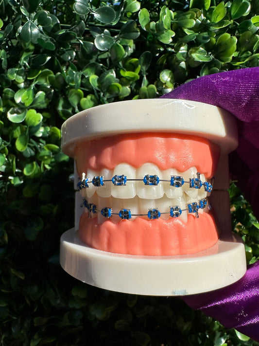 Olinaa® Clip-on Braces